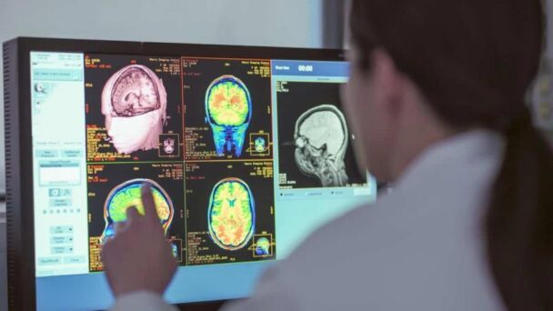 estimulacion-pionera-de-una-region-cerebral-devuelve-la-capacidad-de-andar-a-paraplejicos estimulacion-pionera-de-una-region-cerebral-devuelve-la-capacidad-de-andar-a-paraplejicos