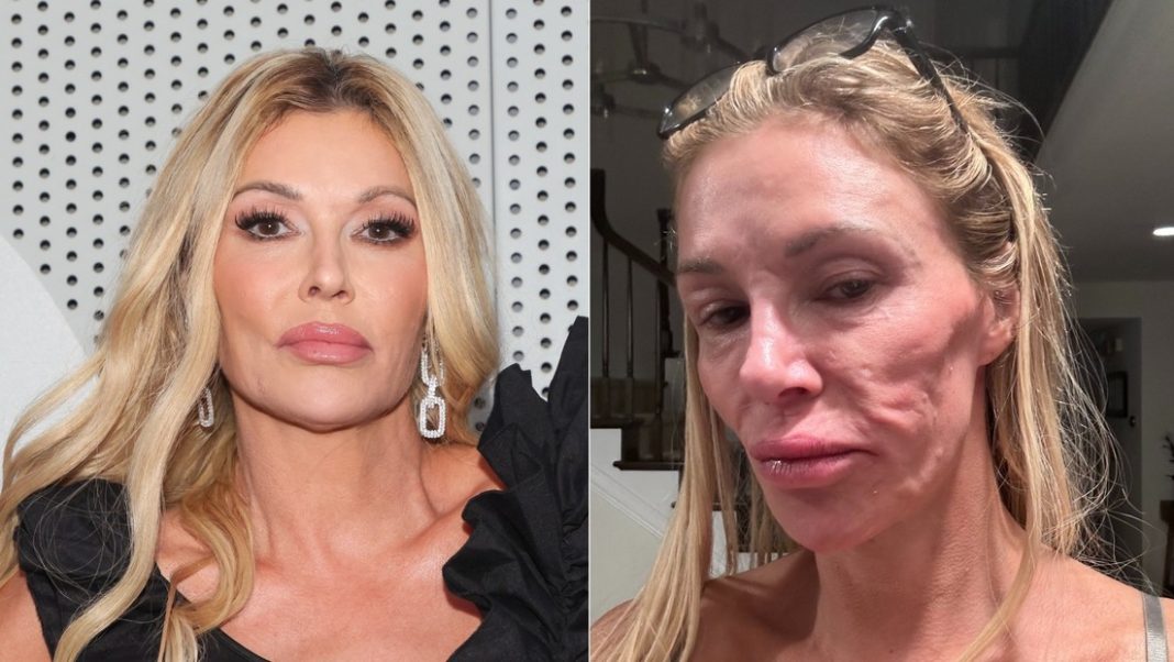 exestrella-de-‘real-housewives’-cuenta-su-lucha-contra-una-rara-enfermedad-facial exestrella-de-‘real-housewives’-cuenta-su-lucha-contra-una-rara-enfermedad-facial