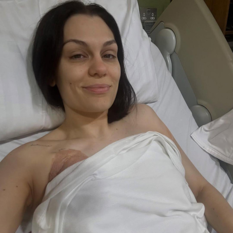 jessie-j-se-recupera-tras-someterse-a-cirugia-por-cancer-de-mama jessie-j-se-recupera-tras-someterse-a-cirugia-por-cancer-de-mama