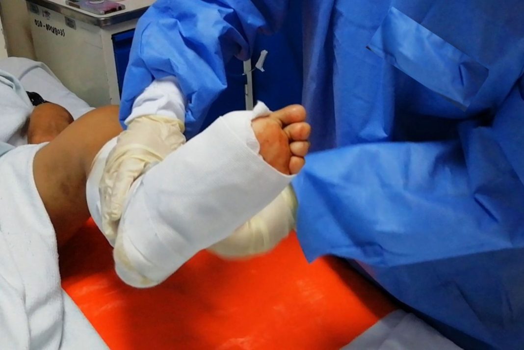 pie-diabetico-causa-mas-de-7,000-muertes-y-amputaciones-cada-ano-en-republica-dominicana pie-diabetico-causa-mas-de-7,000-muertes-y-amputaciones-cada-ano-en-republica-dominicana