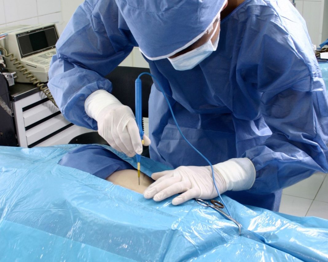 proponen-al-cnss-incluir-reduccion-de-mamas-en-el-seguro-familiar-de-salud proponen-al-cnss-incluir-reduccion-de-mamas-en-el-seguro-familiar-de-salud