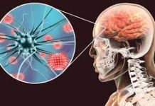 Día Mundial de la Meningitis un desafío que continúa para especialistas de la salud dia-mundial-de-la-meningitis-un-desafio-que-continua-para-especialistas-de-la-salud