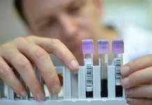 Científicos crean modelo más preciso para evaluar riesgo por hígado graso cientificos-crean-modelo-mas-preciso-para-evaluar-riesgo-por-higado-graso