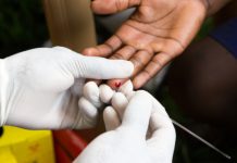 RD tiene más de 85 mil personas viviendo con VIH rd-tiene-mas-de-85-mil-personas-viviendo-con-vih