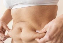 Flacidez cutánea después de perder peso: las opciones más efectivas para recuperar la firmeza flacidez-cutanea-despues-de-perder-peso:-las-opciones-mas-efectivas-para-recuperar-la-firmeza