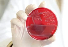 Científicos identifican mecanismo natural que ayuda al cuerpo a frenar la inflamación cientificos-identifican-mecanismo-natural-que-ayuda-al-cuerpo-a-frenar-la-inflamacion