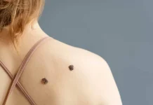 Suplemento de vitamina B3 podría reducir el riesgo de cáncer de piel no melanoma suplemento-de-vitamina-b3-podria-reducir-el-riesgo-de-cancer-de-piel-no-melanoma