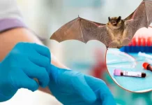 Virus Nipah: Lo que necesitas saber sobre esta amenaza silenciosa virus-nipah:-lo-que-necesitas-saber-sobre-esta-amenaza-silenciosa