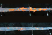 Crean una inmunoterapia para tratar la acumulación de placa arterial cuando fallan los fármacos crean-una-inmunoterapia-para-tratar-la-acumulacion-de-placa-arterial-cuando-fallan-los-farmacos