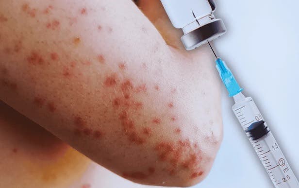 alerta-en-nueva-york:-por-brote-de-sarampion alerta-en-nueva-york:-por-brote-de-sarampion