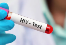 Panamá oficializa plan nacional contra el VIH con meta de frenar la epidemia al 2030 panama-oficializa-plan-nacional-contra-el-vih-con-meta-de-frenar-la-epidemia-al-2030