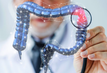 Antecedentes familiares y genética duplican el riesgo de cáncer de colon antecedentes-familiares-y-genetica-duplican-el-riesgo-de-cancer-de-colon