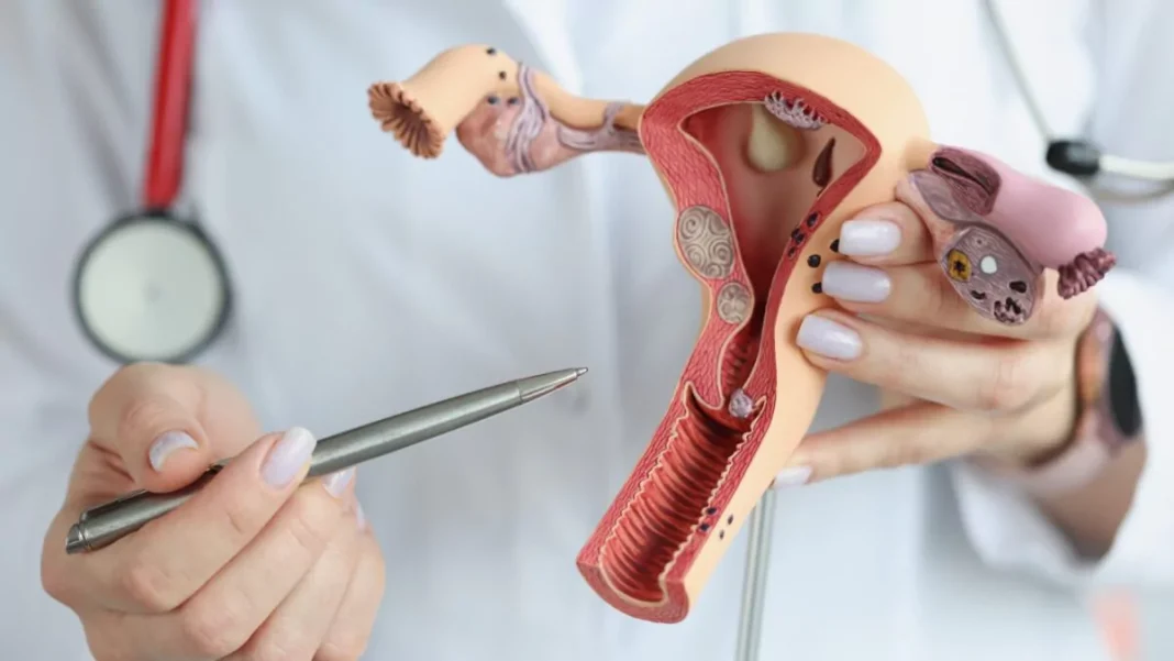 identifican-indicador-clave-que-anticipa-la-recaida-en-el-cancer-de-endometrio-mas-frecuente identifican-indicador-clave-que-anticipa-la-recaida-en-el-cancer-de-endometrio-mas-frecuente