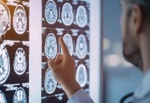 Inteligencia artificial impulsa detección temprana y avances en el tratamiento del Parkinson inteligencia-artificial-impulsa-deteccion-temprana-y-avances-en-el-tratamiento-del-parkinson