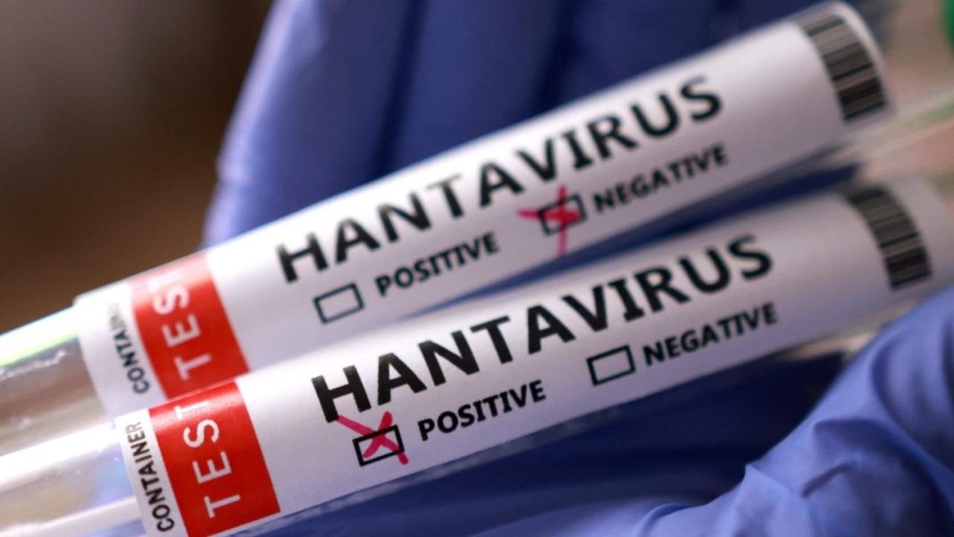 argentina-pone-a-disposicion-pruebas-de-hantavirus-a-paises-afectados-por-brote-en-crucero