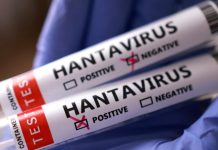 Argentina pone a disposición pruebas de hantavirus a países afectados por brote en crucero argentina-pone-a-disposicion-pruebas-de-hantavirus-a-paises-afectados-por-brote-en-crucero