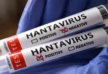 Autoridades sanitarias de EEUU ven «muy bajo» el riesgo del hantavirus para la población autoridades-sanitarias-de-eeuu-ven-«muy-bajo»-el-riesgo-del-hantavirus-para-la-poblacion