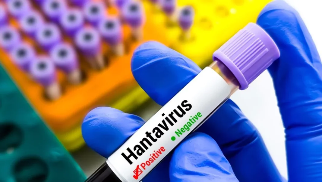 la-mortalidad-por-hantavirus-alcanza-el-50%-entre-adolescentes la-mortalidad-por-hantavirus-alcanza-el-50%-entre-adolescentes