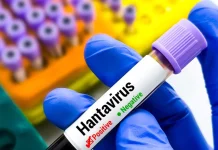 La mortalidad por hantavirus alcanza el 50% entre adolescentes la-mortalidad-por-hantavirus-alcanza-el-50%-entre-adolescentes