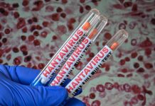 Crisis de hantavirus: 11 casos y bajo riesgo según la OMS crisis-de-hantavirus:-11-casos-y-bajo-riesgo-segun-la-oms